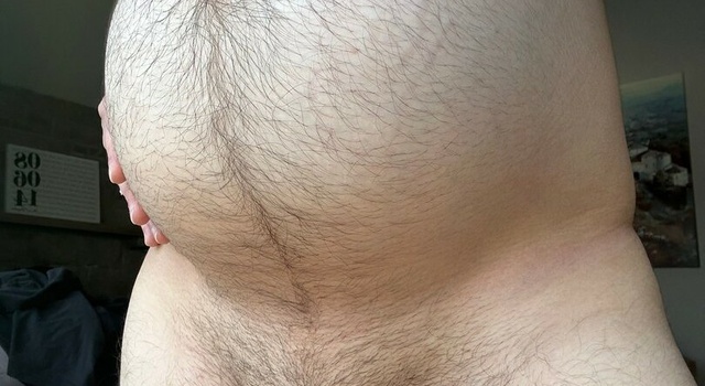 Hairy Pregnant