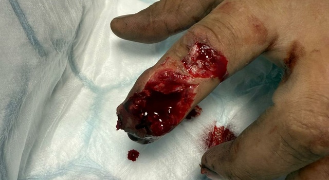 FINGER BANG