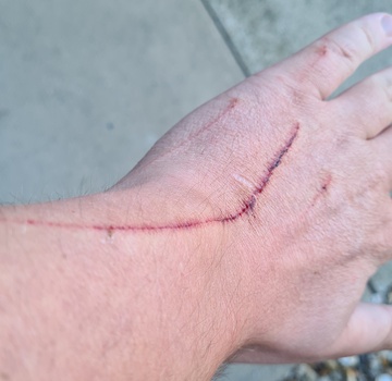 I Got Mangled By Pussy