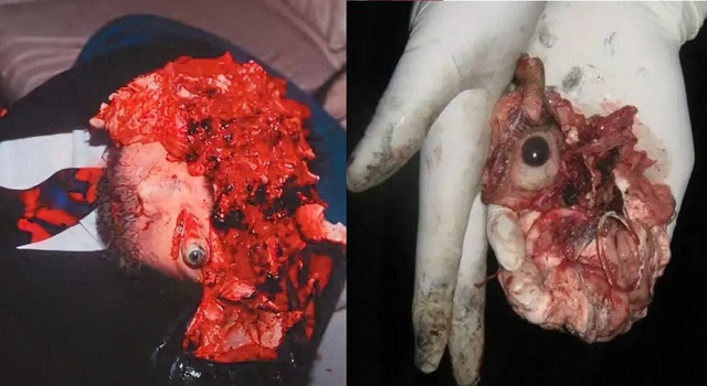 Eye see you