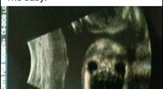 pregnant woman