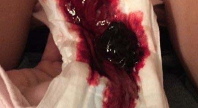 Nurse Ratched sent me thes pictures.