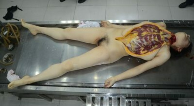 Chinese Woman Autopsy