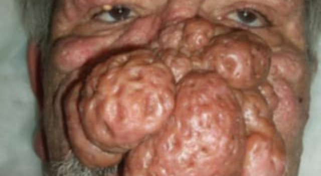 I Don&rsquo;t Nose&hellip;..