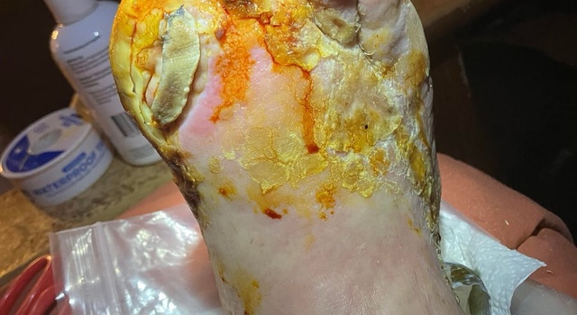 Slop&hellip;..