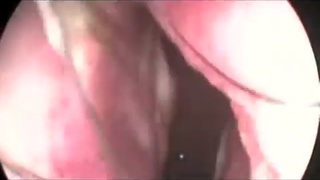 What Is Really Up Your Nose