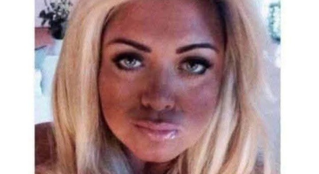 Natural Tanning