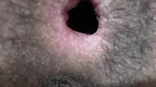 The black hole