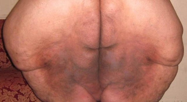 Lard&hellip;..