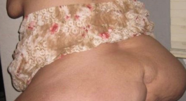 Body&hellip;..